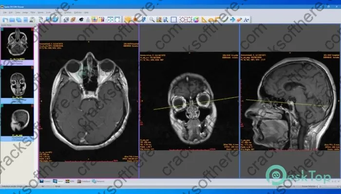 Sante Dicom Viewer Pro Crack 14.0.2 Free Download