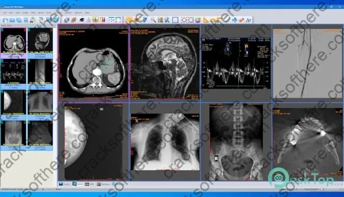 Sante Dicom Editor Keygen 10.0.5 Free Full Activated